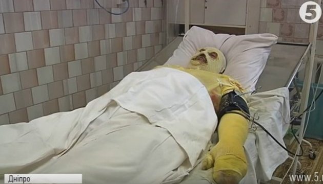 У Дніпрі лікарі намагаються врятувати бійця 54-ї мехбригади У Дніпрі лікарі намагаються врятувати бійця 54-ї мехбригади