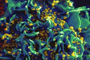 В США создали антитело, нейтрализующее 99% штаммов ВИЧ