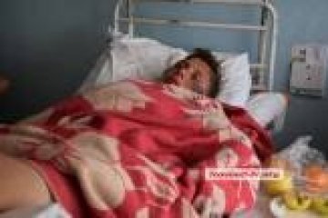 У Миколаєві неповнолітній стверджує, що поліцейські поламали йому кістки