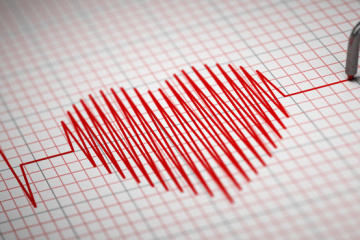 В Україні від серцево-судинних захворювань щороку гине півмільйона людей — кардіохірург