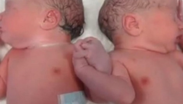 Дружні з народження близнята стали інтернет-улюбленцями. ВІДЕО