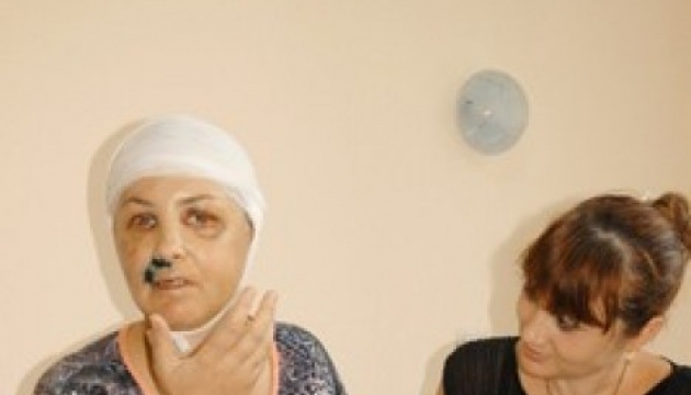 Головлікар Врадіївської лікарні запевняє, що не причетна до фальсифікації акту огляду Крашкової