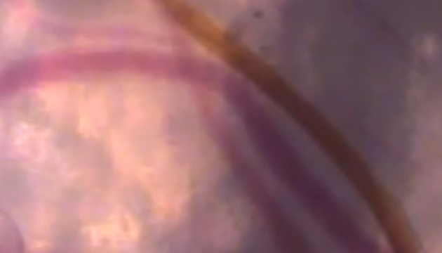 Як кусається комар. Відео