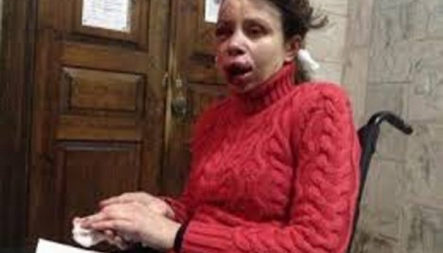 Yanukovych demands immediate probe into beating of journalist Tetiana Chornovol