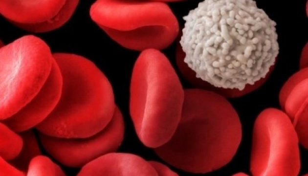 Вчені вперше відзняли, як вмирає лейкоцит. Відео