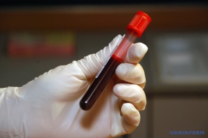 В Україні зареєстровані понад 158 тисяч випадків ВІЛ-інфекції