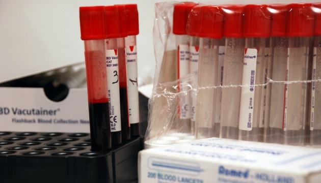 Японські вчені відкрили дві нові групи крові