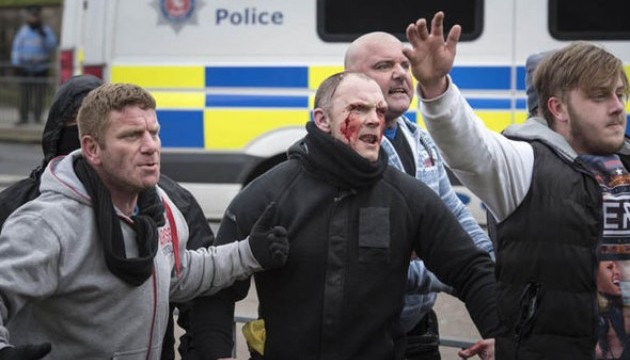 У британському Дуврі акція проти мігрантів закінчилася бійками, є поранений