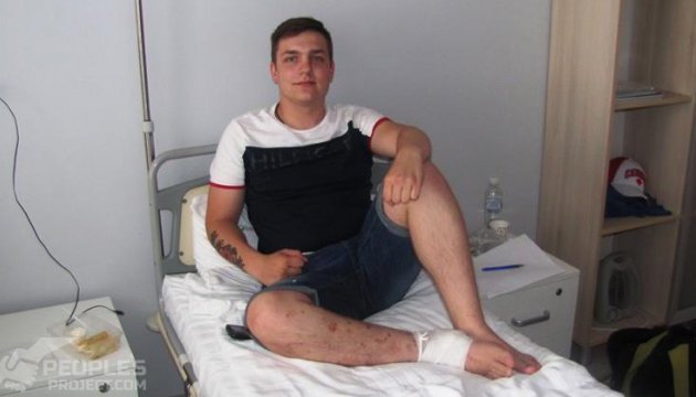 Українські біотехнологи відновили добровольцю розтрощену під Пісками ногу