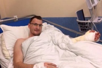Польські хірурги вперше у світі пересадили кисть народженій без рук людині