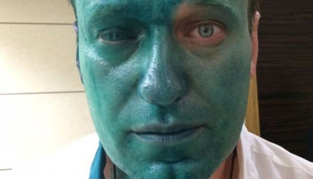 Навальний заявив, що може втратити око