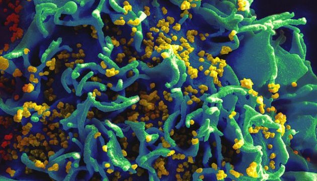 В США создали антитело, нейтрализующее 99% штаммов ВИЧ