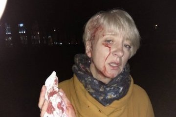 Полтавська суддя заявляє про побиття, каже напали