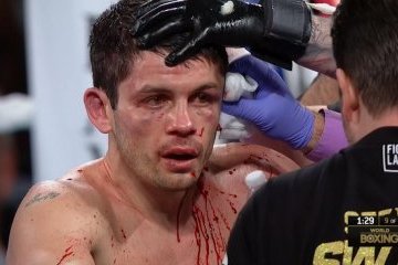 Мексиканський боксер мало не відірвав вухо супернику