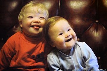 Сьогодні - Всесвітній день людей з синдромом Дауна