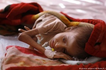 В Йемене еще 20 лет будут страдать от нехватки продовольствия из-за войны