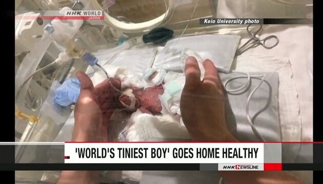 В Японії виписали з лікарні найменшу дитину у світі, яка вижила