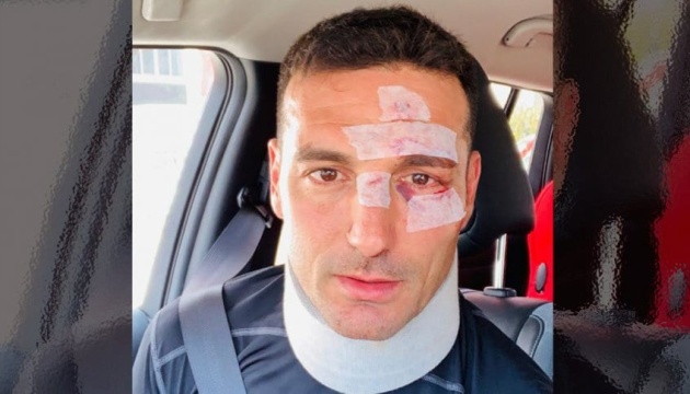 Наставник збірної Аргентини з футболу зазнав важких тілесних ушкоджень в ДТП
