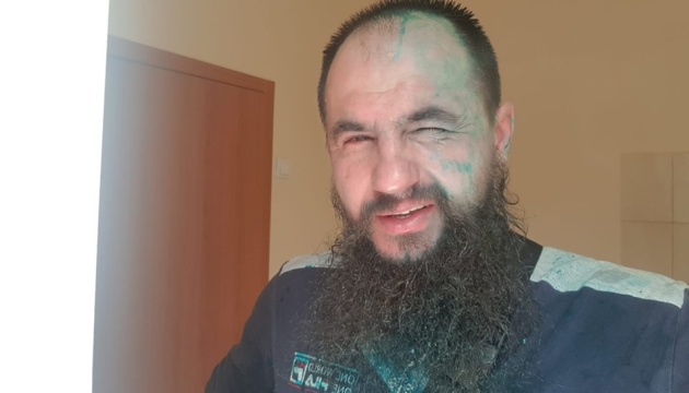 У Харкові облили зеленкою сепаратиста Головачова У Харкові облили зеленкою сепаратиста Головачова