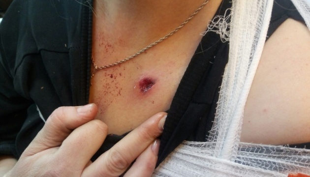 Donbass : Une jeune femme blessée par balle à Mariinka 