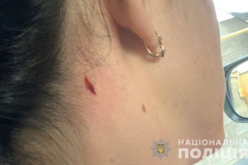 Поліція Миколаєва розслідує поранення жінки поблизу стрільбища