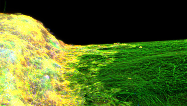 Учені вперше створили 3D-модель нервової системи на основі стовбурових клітин