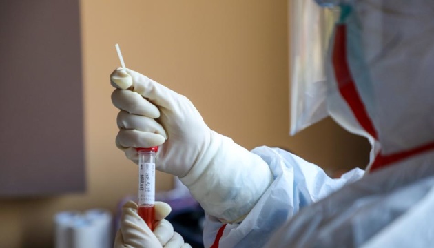 Реагенти для виявлення коронавірусу доправили в регіональні лабораторії - ОП