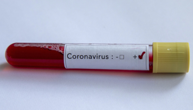 В Бельгии количество зараженных коронавирусом за сутки выросло на 27%