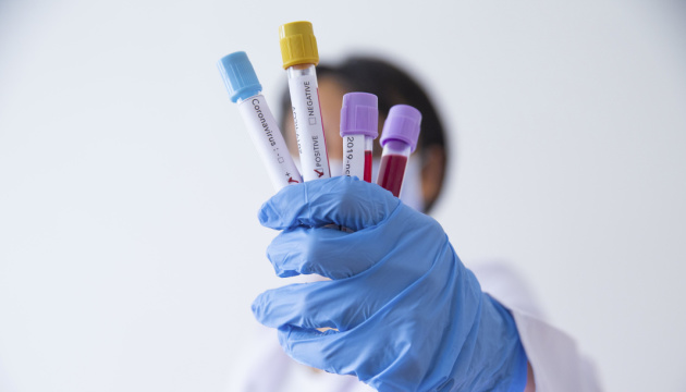 На Житомирщині лабораторно підтвердили п’ятий випадок коронавірусу