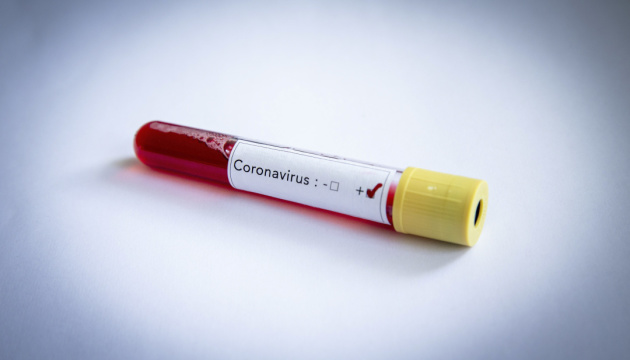 У померлої жительки Сумщини підтвердили коронавірус, заражені троє її родичів