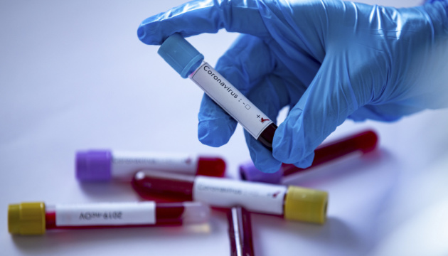 Підозра на коронавірус: МОЗ чекає результати тестів українки з Італії
