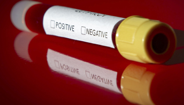 У Чернівцях хворий на коронавірус пацієнт одужує - перший тест дав негативний результат