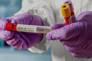 Динаміка збільшення інфікованих COVID-19 в Україні у 2020 році. Інфографіка
