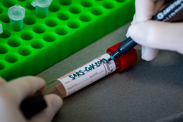 В Україні зафіксували 548 випадків коронавірусу