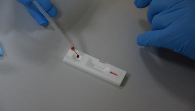 Київ вже отримав 9 тисяч експрес-тестів на коронавірус