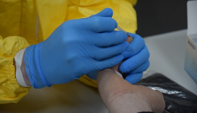 Ukraine develops coronavirus diagnostic tests