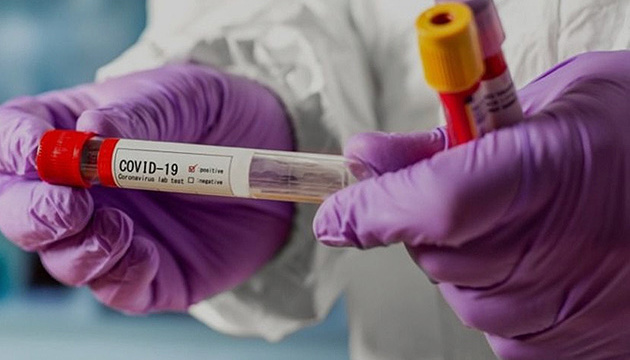 В Україні вже 794 випадки коронавірусу, 20 смертей
