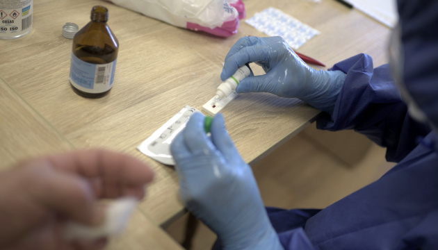 В Україні за потреби робитимуть 30 тисяч тестів на коронавірус на тиждень — Ляшко