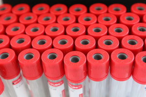 В Украине за сутки зафиксировали 37 351 случай коронавируса