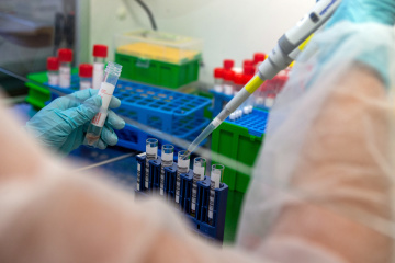 Ucrania suma 9.866 casos de COVID-19 tras confirmarse 456 nuevos contagios
