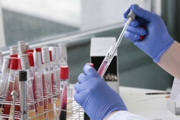 Ucrania suma 19.706 casos de COVID-19 tras confirmarse 476 nuevos contagios