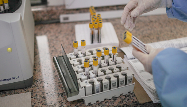 У Німеччині почали тестувати COVID-вакцину на людях