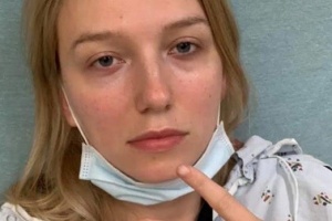 Kopfverletzung und gebrochene Zehen: Ukrainische Journalistin bei Protesten in den USA angegriffen