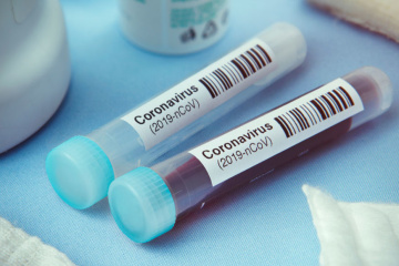 Na Ukrainie zarejestrowano 2671 nowych przypadków koronawirusa