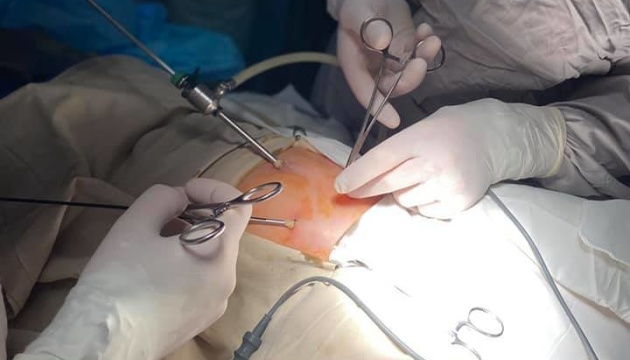 Хірурги львівського Охматдиту зробили немовляті надскладну операцію 