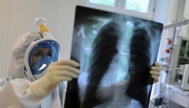 Штам Омікрон менше вражає легені – пульмонолог