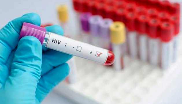 Львів’ян закликають пройти безкоштовні тестування на ВІЛ та гепатит