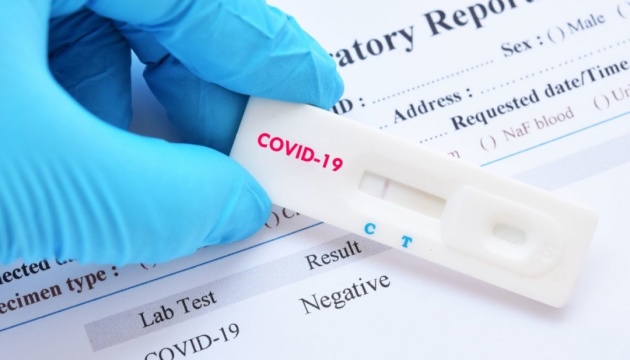 МОЗ радить робити тест на коронавірус за будь-яких ознак застуди