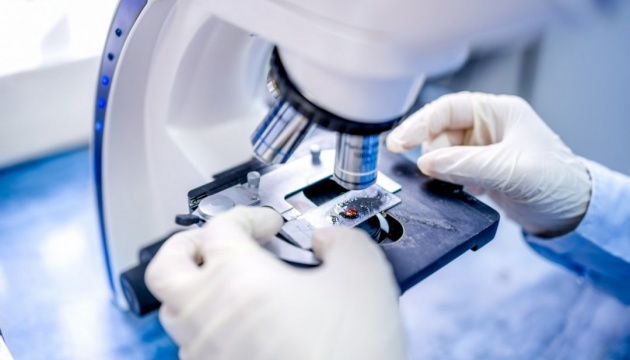 Tratamiento del coronavirus con células madre: los científicos ucranianos reciben los primeros resultados de la investigación

