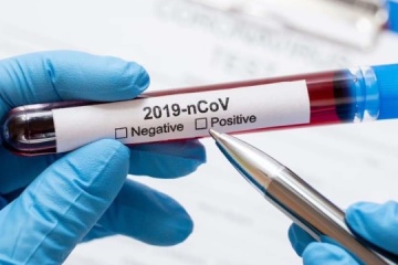Coronavirus: In Kyjiw 77 Neuinfektionen registriert